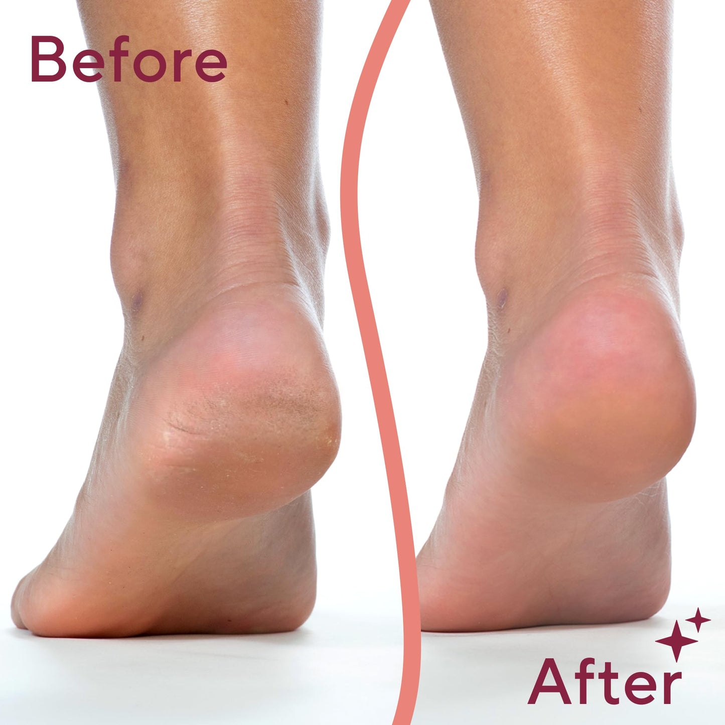 Finishing Touch Flawless Pedi Electronic Tool File and Callus Remover, Pedicure-New Version (Amazon Exclusive)